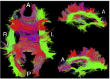 Streamlines of the selected significant connections