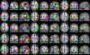 Illustration of the parcellation results.