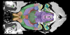 T2*-weighted MRI template with atlas labels