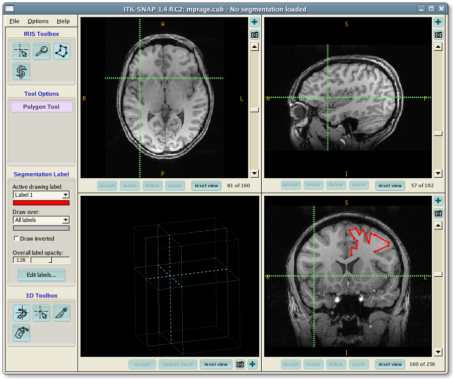 Manual segmentation in ITK-SNAP