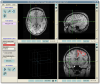 Manual segmentation in ITK-SNAP