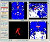 Active contour segmentation
