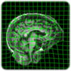 Deformed brain image