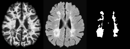 Lesion segmentation from T1 and FLAIR