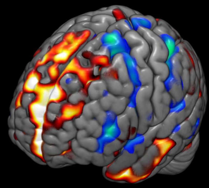 UF²C Seed Based Results Map (DMN). Renderized with MRIcroGL