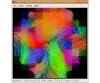 Example use - DT deterministic streamlines (using MRtrix)