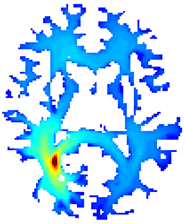 Connectivity between the source (red) and other voxels.