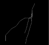 Extracted centerline using VMTKCenterlines in 3D Slicer