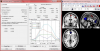 Statistics and Images