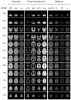 Channels of the SRI24 atlas (axial slices)