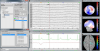 Continuous recordings and markers