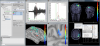 Cortical regions of interest
