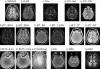 Survey of Imaging Modalities