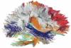 Graphic for DIPY Diffusion Imaging Analysis