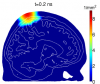 MMC brain simulations