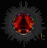 Connectome