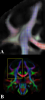 Example of the ODFs in a coronal slice of the atlas.