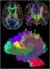 Example of DOTS WM segmentation