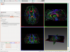 Q-Ball reconstruction and image visualization