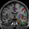 Half-Labeled 1103_3_167