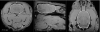 Outline of brain mask generated from a T1-weighted image