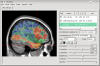VoxBo screenshot