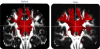 Multi-resolution NLM