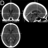 CT template from clinical toolbox