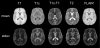 STAMP atlases, axial view.